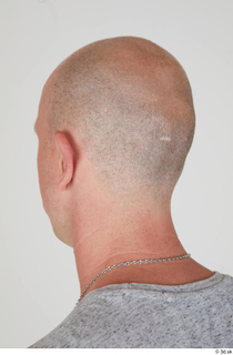  Photos Reece Griffiths bald head 0003.jpg